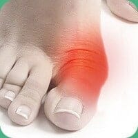 hallux